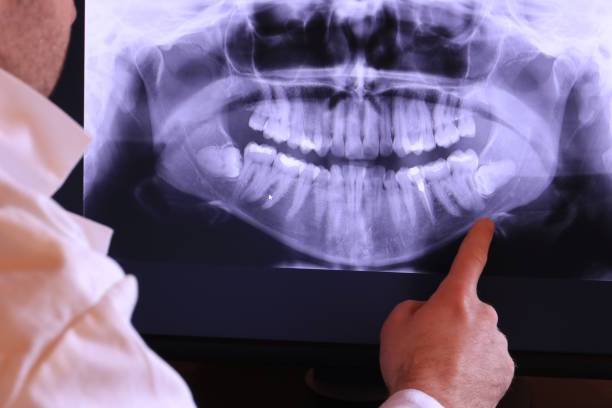 Best Emergency Treatment for Dental Infections or Abscesses in Bushland, TX