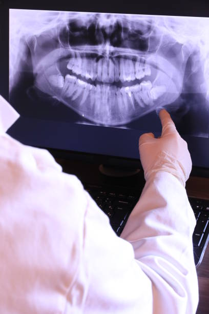 Best Emergency Tooth Extraction in Bushland, TX
