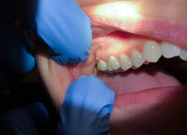 Best Emergency Denture Repair in Bushland, TX