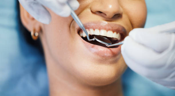 Best Emergency Dental Care for Broken or Chipped Teeth in Bushland, TX